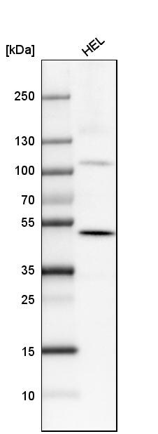 SATB2 Antibody (CL0276) - Azide and BSA Free Western Blot: SATB2 Antibody [NBP3-44079]