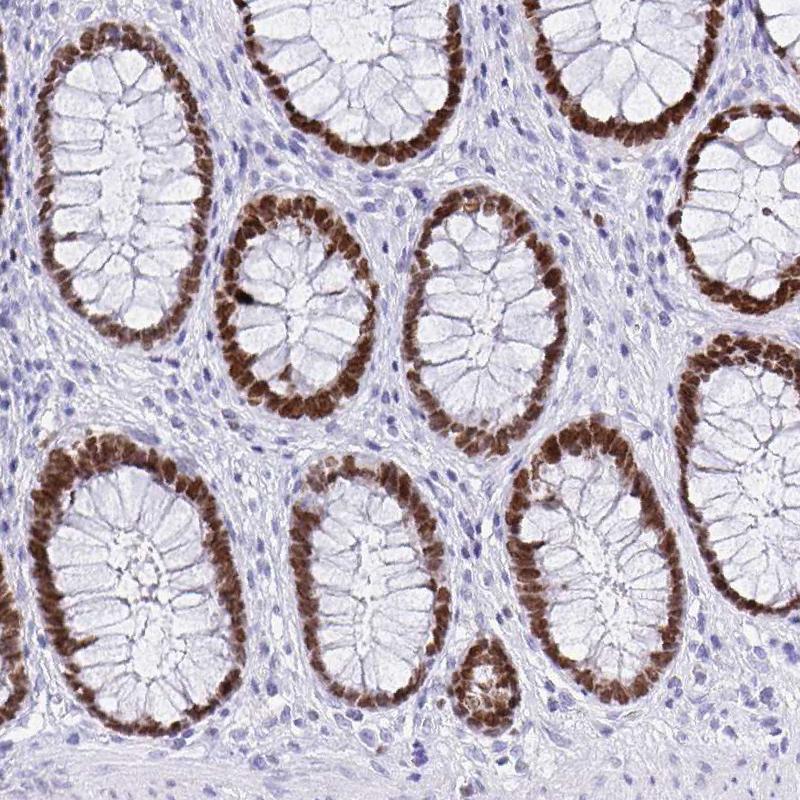 SATB2 Antibody (CL0276) - Azide and BSA Free Immunohistochemistry-Paraffin: SATB2 Antibody [NBP3-44079]