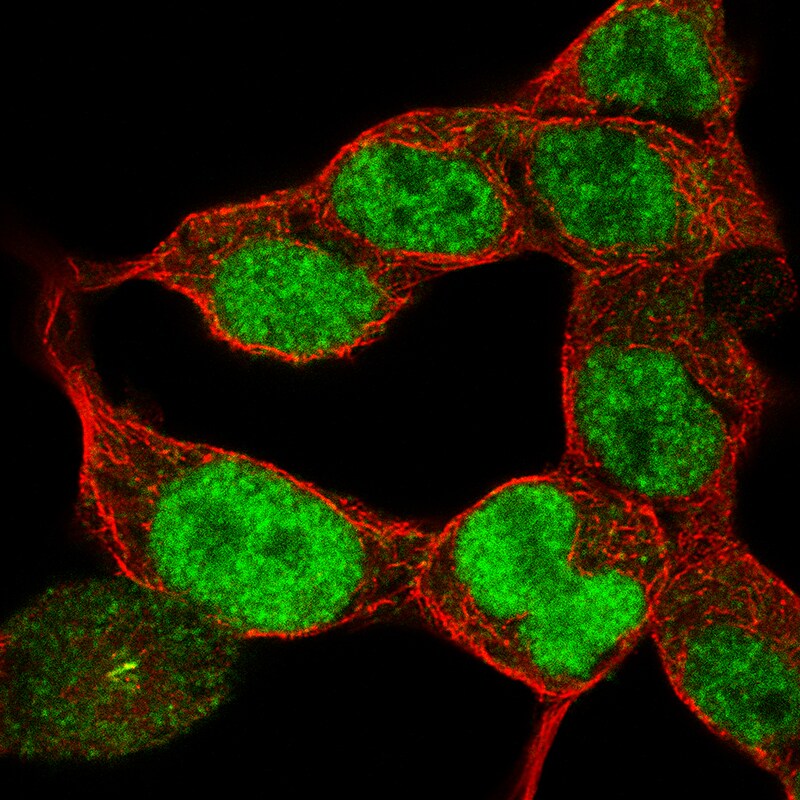 Pax6 Antibody (CL5414) - Azide and BSA Free Immunocytochemistry/ Immunofluorescence: Pax6 Antibody [NBP3-44080]