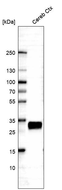 CD90/Thy1 Antibody (CL1028) - Azide and BSA Free Western Blot: CD90/Thy1 Antibody [NBP3-44081]