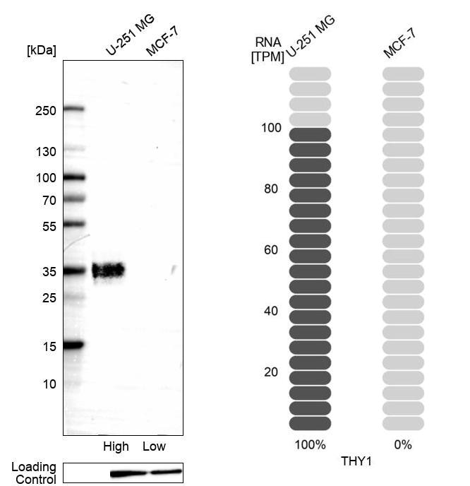 CD90/Thy1 Antibody (CL1040) - Azide and BSA Free Western Blot: CD90/Thy1 Antibody [NBP3-44082]