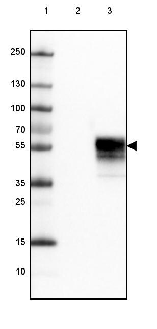 PD-1 Antibody (CL3624) - Azide and BSA Free Western Blot: PD-1 Antibody [NBP3-44083]