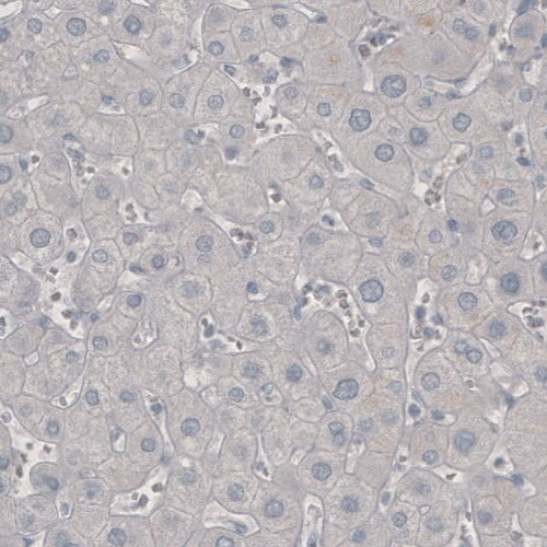 PD-1 Antibody (CL3624) - Azide and BSA Free Immunohistochemistry-Paraffin: PD-1 Antibody [NBP3-44083]