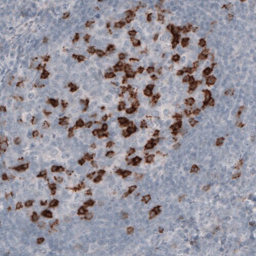 PD-1 Antibody (CL3624) - Azide and BSA Free Immunohistochemistry-Paraffin: PD-1 Antibody [NBP3-44083]