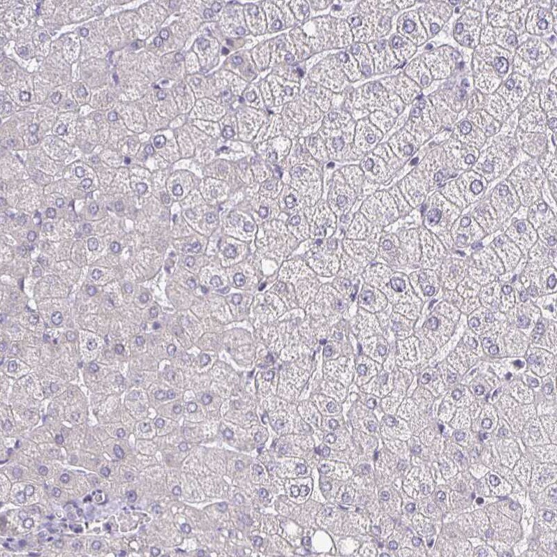 ErbB2/Her2 Antibody (CL0268) - Azide and BSA Free Immunohistochemistry-Paraffin: ErbB2/Her2 Antibody [NBP3-44084]