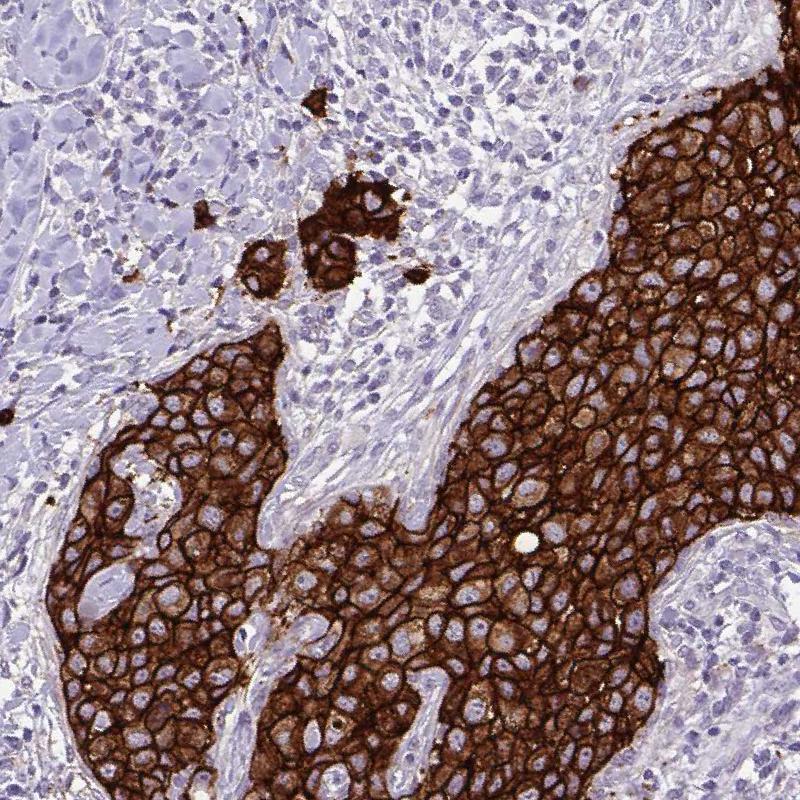 ErbB2/Her2 Antibody (CL0268) - Azide and BSA Free Immunohistochemistry-Paraffin: ErbB2/Her2 Antibody [NBP3-44084]