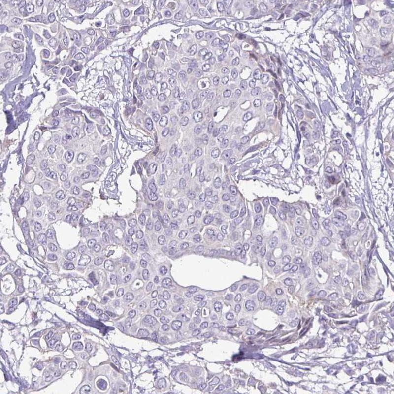 ErbB2/Her2 Antibody (CL0268) - Azide and BSA Free Immunohistochemistry-Paraffin: ErbB2/Her2 Antibody [NBP3-44084]
