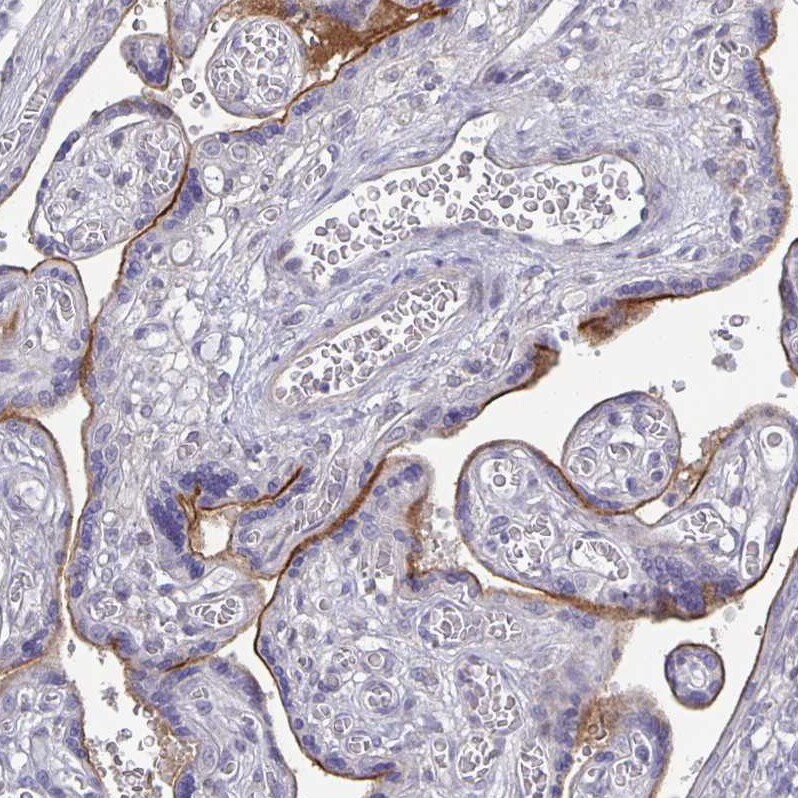 ErbB2/Her2 Antibody (CL0268) - Azide and BSA Free Immunohistochemistry-Paraffin: ErbB2/Her2 Antibody [NBP3-44084]