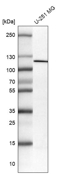 NLRP3/NALP3 Antibody (CL0210) - Azide and BSA Free Western Blot: NLRP3/NALP3 Antibody [NBP3-44085]