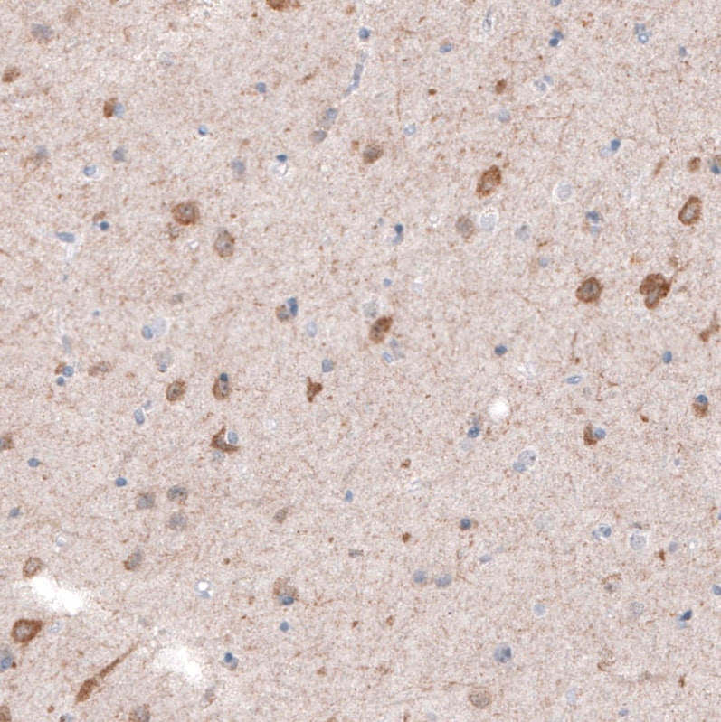 CDKL5 Antibody (CL4881) - Azide and BSA Free Immunohistochemistry-Paraffin: CDKL5 Antibody [NBP3-44086]