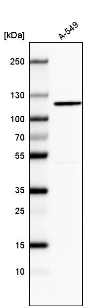CDKL5 Antibody (CL4881) - Azide and BSA Free Western Blot: CDKL5 Antibody [NBP3-44086]