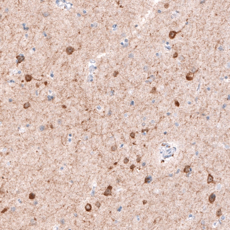 CDKL5 Antibody (CL4888) - Azide and BSA Free Immunohistochemistry-Paraffin: CDKL5 Antibody [NBP3-44087]