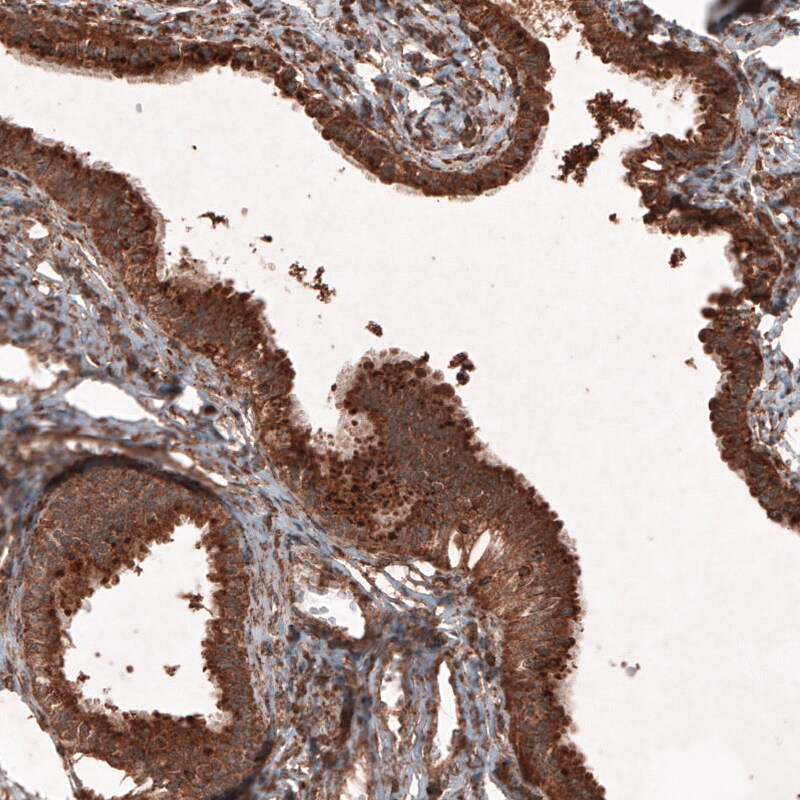 LAMP-1/CD107a Antibody (CL4463) - Azide and BSA Free Immunohistochemistry-Paraffin: LAMP-1/CD107a Antibody [NBP3-44090]