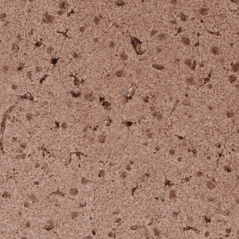 LAMP-1/CD107a Antibody (CL4463) - Azide and BSA Free Immunohistochemistry-Paraffin: LAMP-1/CD107a Antibody [NBP3-44090]