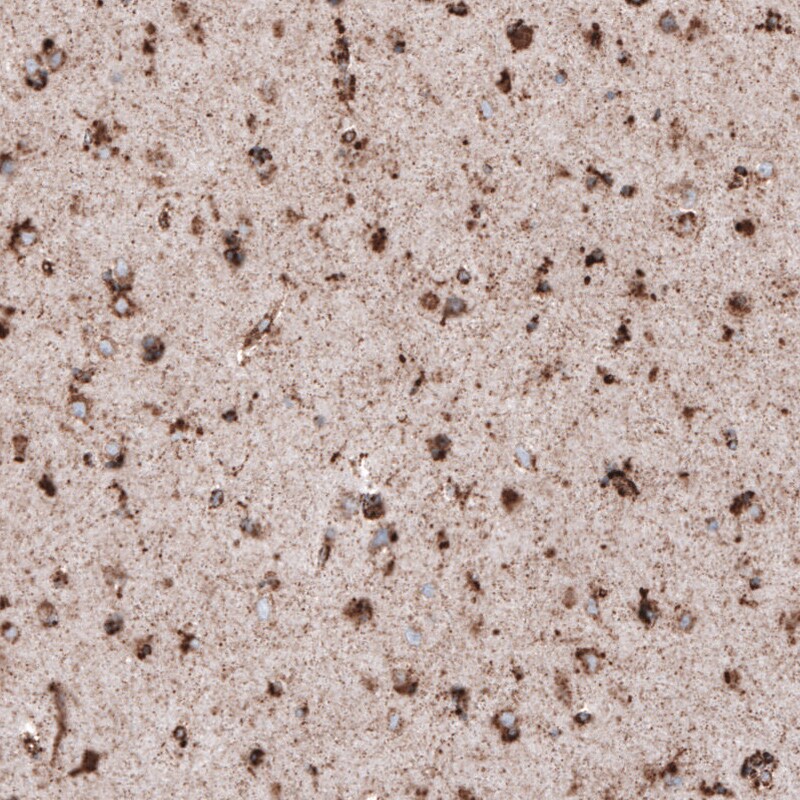 LAMP-1/CD107a Antibody (CL4472) - Azide and BSA Free Immunohistochemistry-Paraffin: LAMP-1/CD107a Antibody [NBP3-44091]