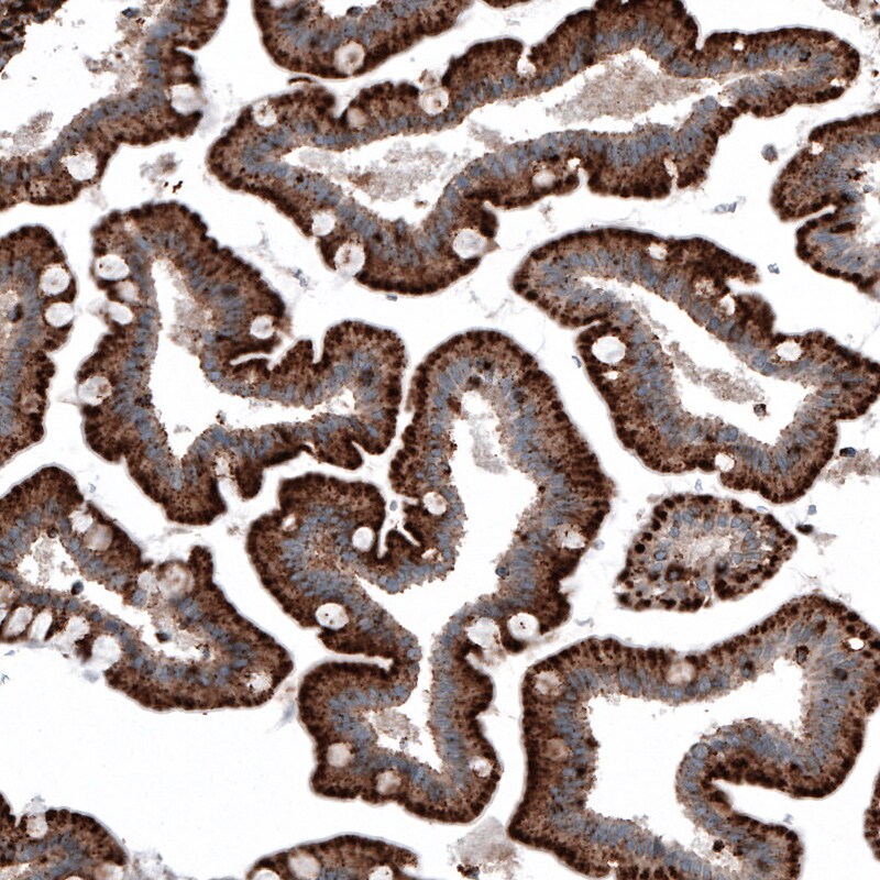 LAMP-1/CD107a Antibody (CL4472) - Azide and BSA Free Immunohistochemistry-Paraffin: LAMP-1/CD107a Antibody [NBP3-44091]