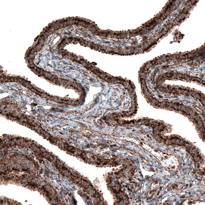 LAMP-1/CD107a Antibody (CL4472) - Azide and BSA Free Immunohistochemistry-Paraffin: LAMP-1/CD107a Antibody [NBP3-44091]
