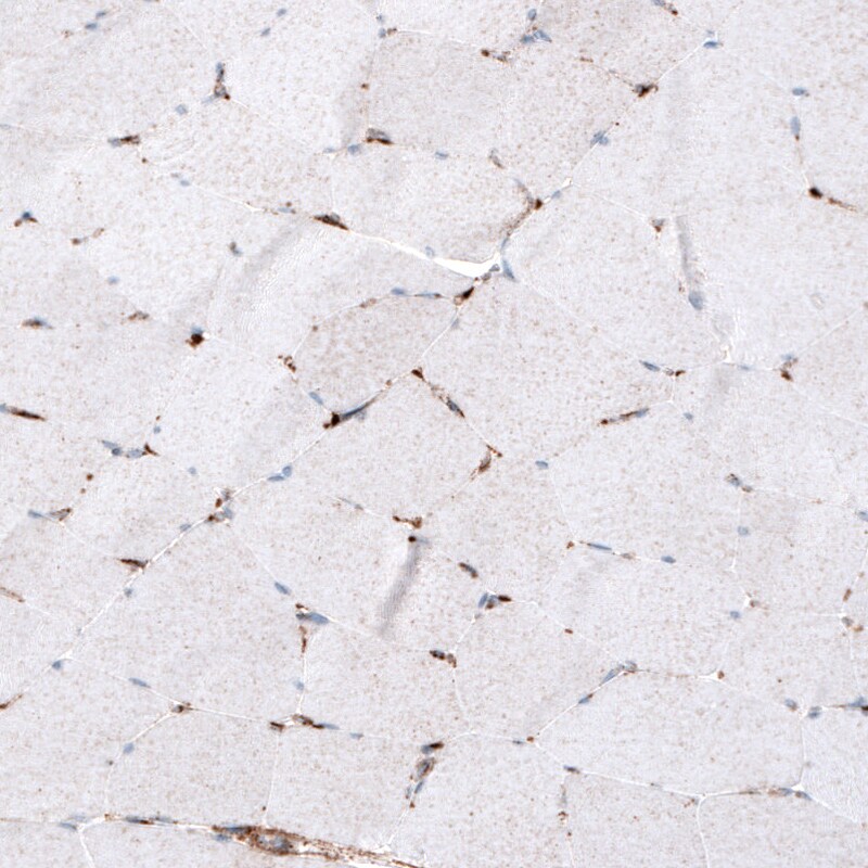 LAMP-1/CD107a Antibody (CL4472) - Azide and BSA Free Immunohistochemistry-Paraffin: LAMP-1/CD107a Antibody [NBP3-44091]