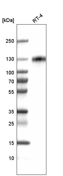 LAMP-1/CD107a Antibody (CL4472) - Azide and BSA Free Western Blot: LAMP-1/CD107a Antibody [NBP3-44091]