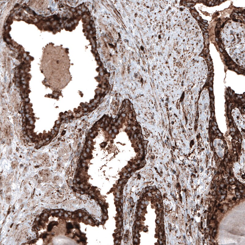 LAMP-1/CD107a Antibody (CL4472) - Azide and BSA Free Immunohistochemistry-Paraffin: LAMP-1/CD107a Antibody [NBP3-44091]