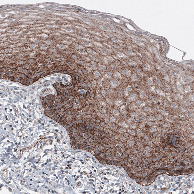 LAMP-1/CD107a Antibody (CL4489) - Azide and BSA Free Immunohistochemistry-Paraffin: LAMP-1/CD107a Antibody [NBP3-44092]