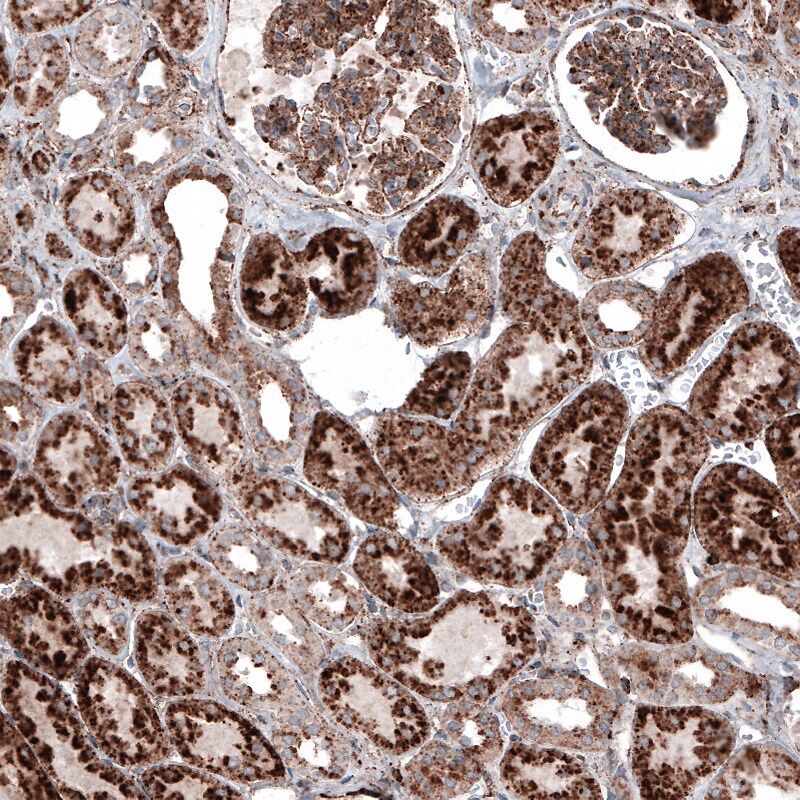 LAMP-1/CD107a Antibody (CL4489) - Azide and BSA Free Immunohistochemistry-Paraffin: LAMP-1/CD107a Antibody [NBP3-44092]
