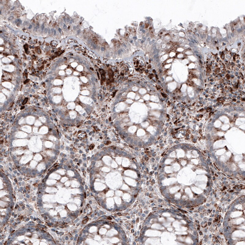 LAMP-1/CD107a Antibody (CL4489) - Azide and BSA Free Immunohistochemistry-Paraffin: LAMP-1/CD107a Antibody [NBP3-44092]