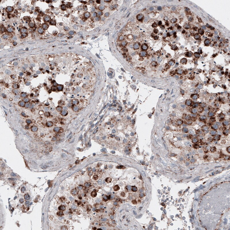 LAMP-1/CD107a Antibody (CL4489) - Azide and BSA Free Immunohistochemistry-Paraffin: LAMP-1/CD107a Antibody [NBP3-44092]