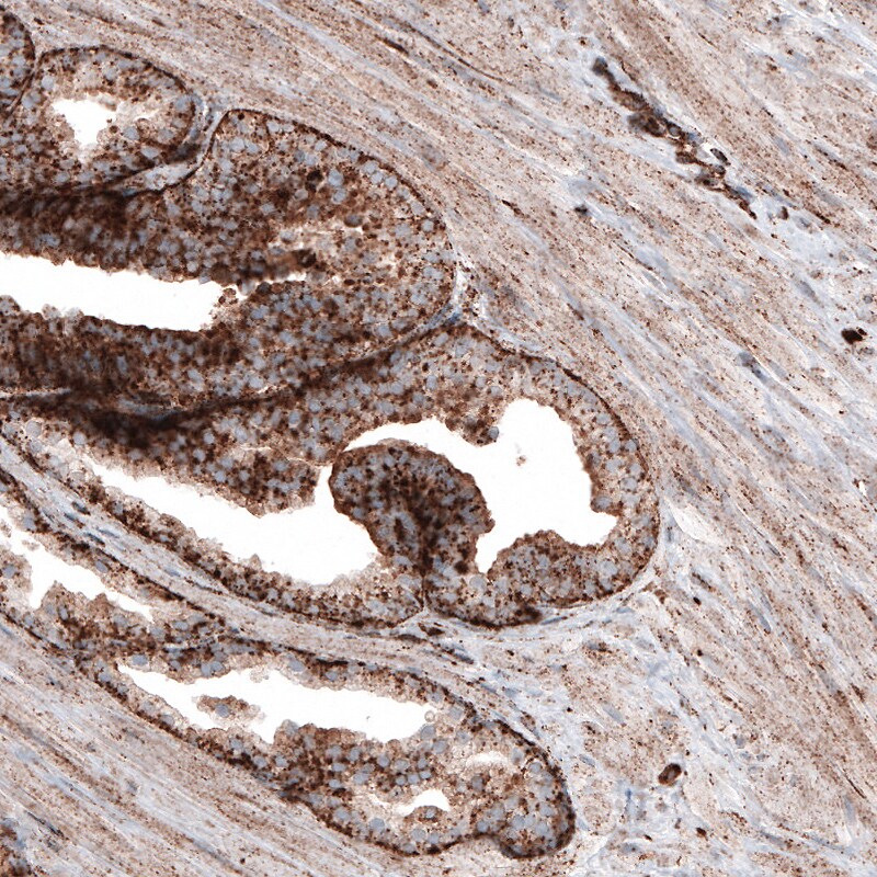 LAMP-1/CD107a Antibody (CL4490) - Azide and BSA Free Immunohistochemistry-Paraffin: LAMP-1/CD107a Antibody [NBP3-44093]