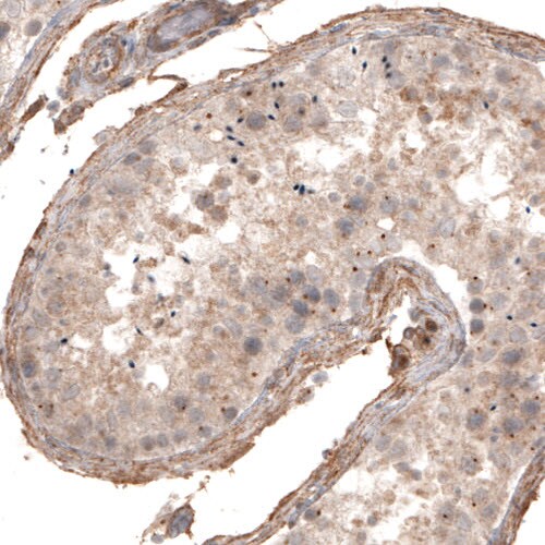 CDK5RAP2 Antibody (CL3392) - Azide and BSA Free Immunohistochemistry-Paraffin: CDK5RAP2 Antibody [NBP3-44094]