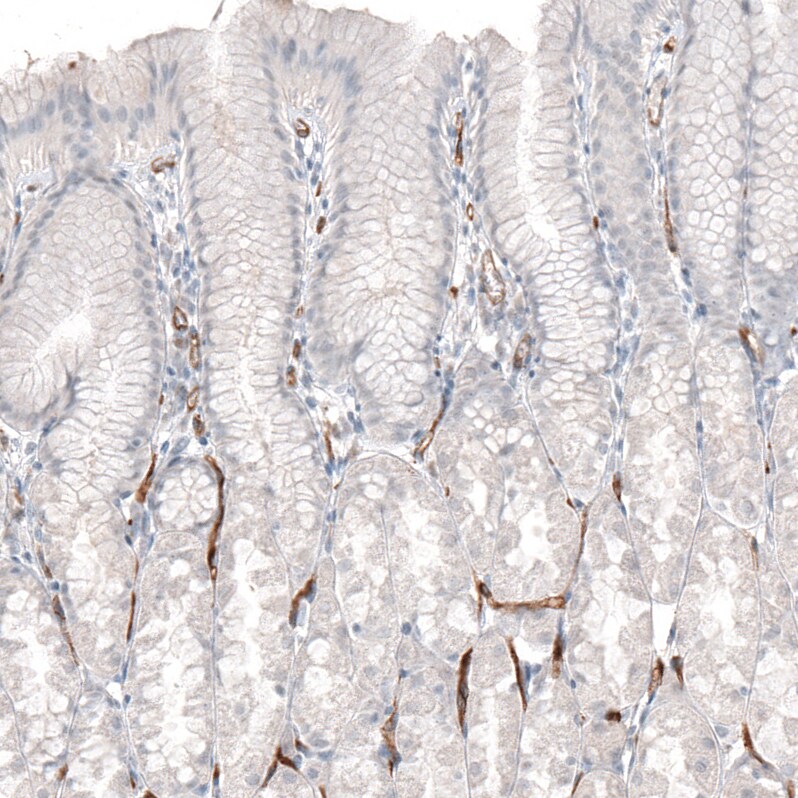 ELTD1/ETL Antibody (CL4164) - Azide and BSA Free Immunohistochemistry-Paraffin: ELTD1/ETL Antibody [NBP3-44095]