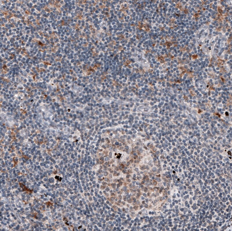 Mkl1 Antibody (CL4281) - Azide and BSA Free Immunohistochemistry-Paraffin: Mkl1 Antibody [NBP3-44096]