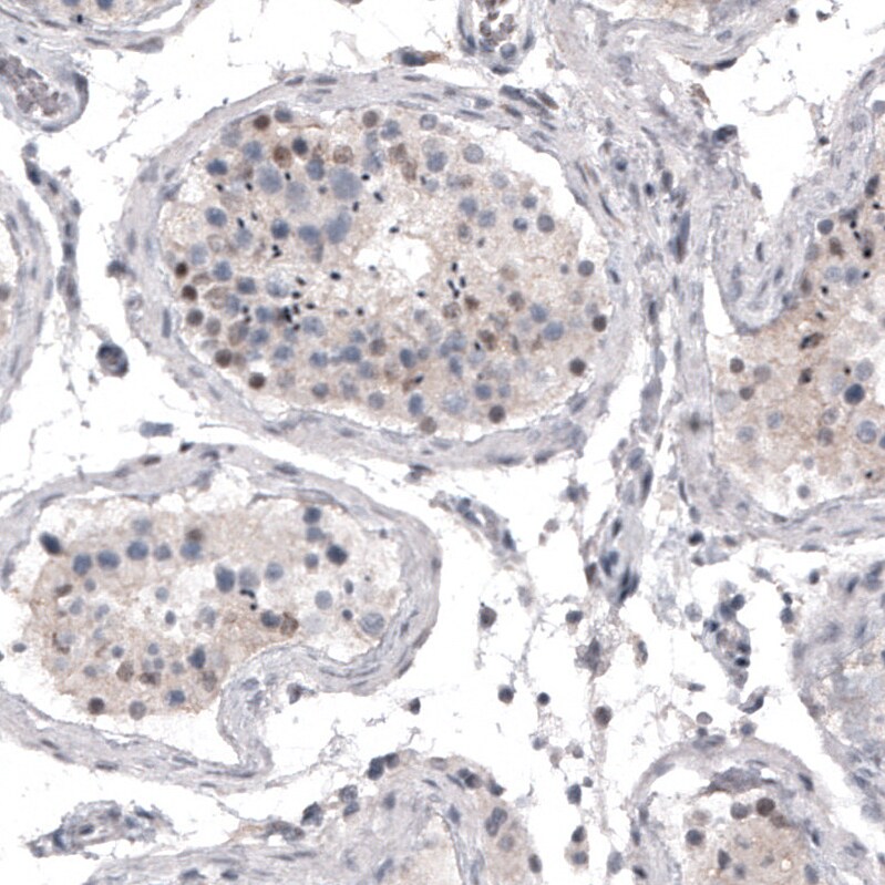 Mkl1 Antibody (CL4281) - Azide and BSA Free Immunohistochemistry-Paraffin: Mkl1 Antibody [NBP3-44096]