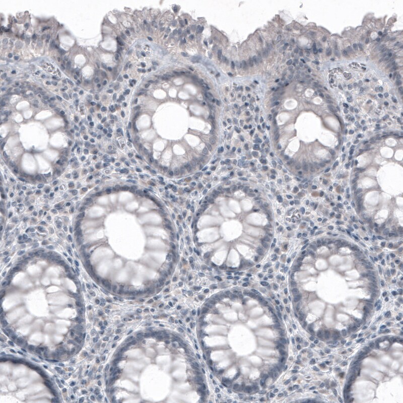 SOX21 Antibody (CL4681) - Azide and BSA Free Immunohistochemistry-Paraffin: SOX21 Antibody [NBP3-44097]