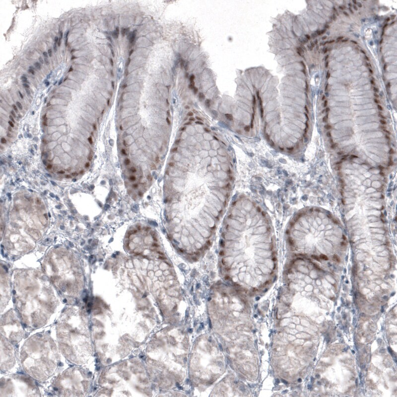 SOX21 Antibody (CL4681) - Azide and BSA Free Immunohistochemistry-Paraffin: SOX21 Antibody [NBP3-44097]