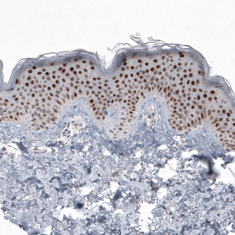 SOX21 Antibody (CL4681) - Azide and BSA Free Immunohistochemistry-Paraffin: SOX21 Antibody [NBP3-44097]