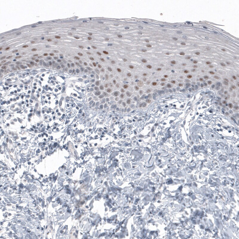 SOX21 Antibody (CL4688) - Azide and BSA Free Immunohistochemistry-Paraffin: SOX21 Antibody [NBP3-44098]