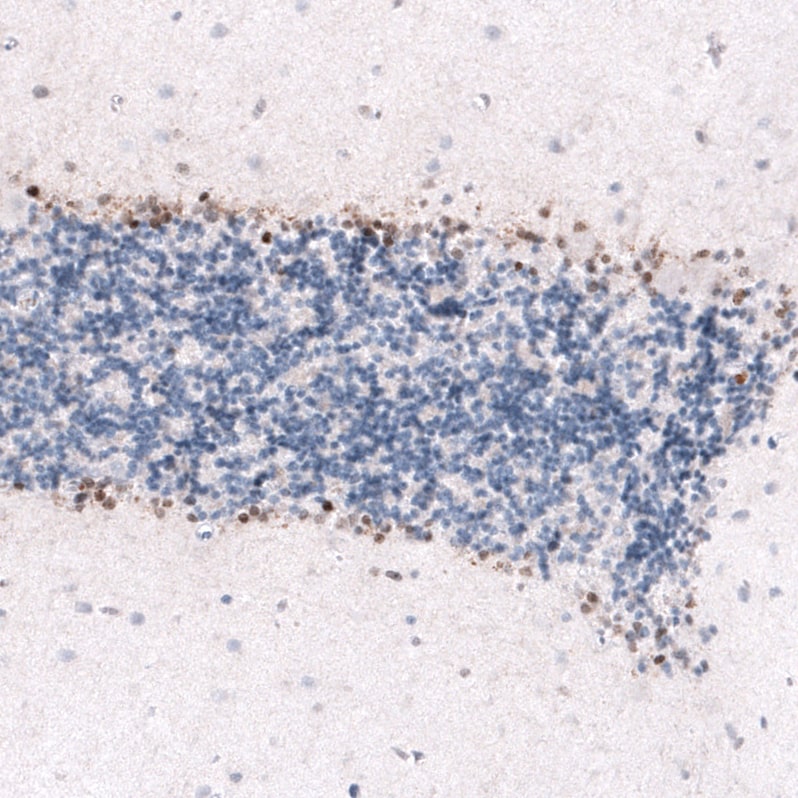 SOX2 Antibody (CL4716) - Azide and BSA Free Immunohistochemistry-Paraffin: SOX2 Antibody [NBP3-44099]