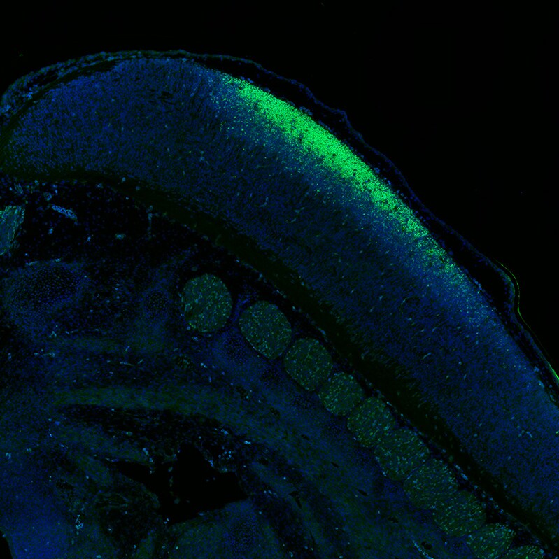 SOX2 Antibody (CL4716) - Azide and BSA Free Immunohistochemistry-Paraffin: SOX2 Antibody [NBP3-44099]