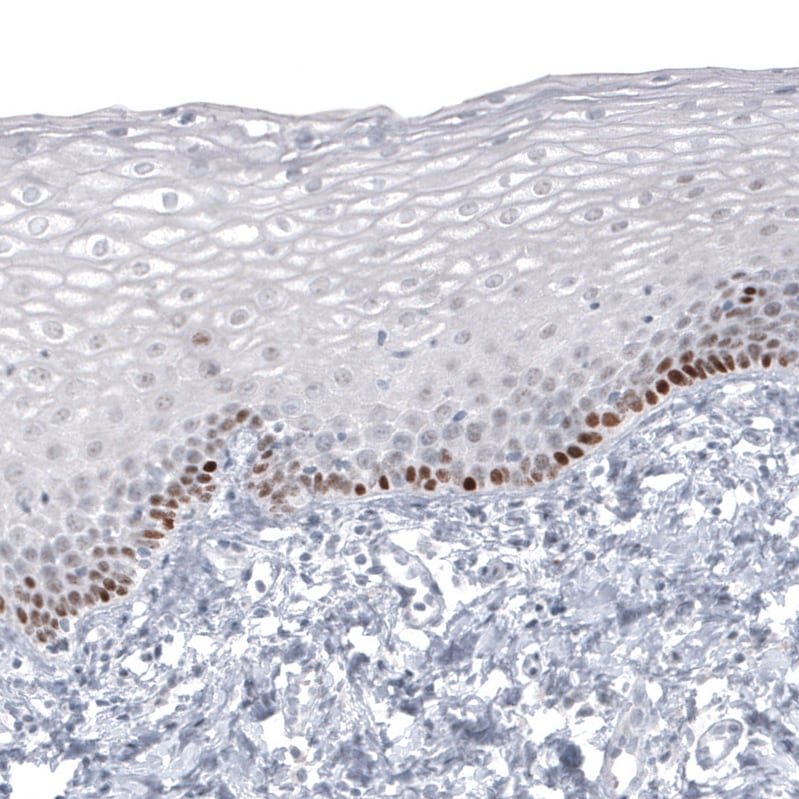SOX2 Antibody (CL4716) - Azide and BSA Free Immunohistochemistry-Paraffin: SOX2 Antibody [NBP3-44099]