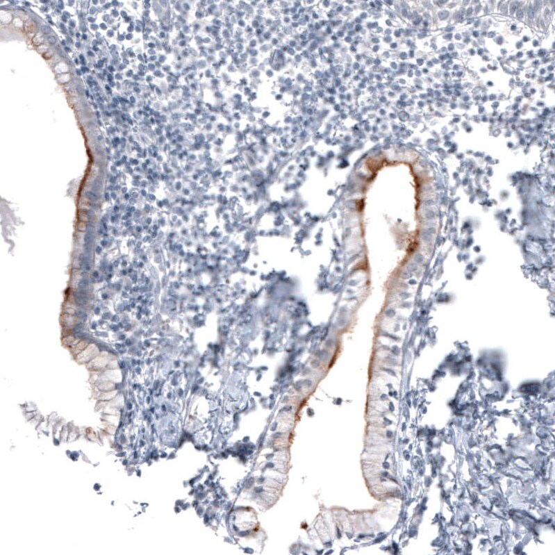 CA125/MUC16 Antibody (CL2782) - Azide and BSA Free Immunohistochemistry-Paraffin: CA125/MUC16 Antibody [NBP3-44100]