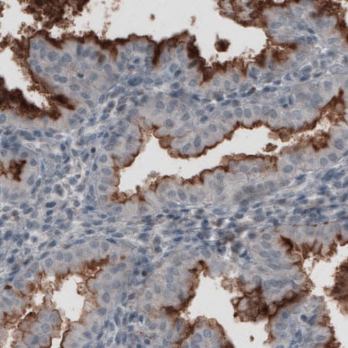 CA125/MUC16 Antibody (CL2783) - Azide and BSA Free Immunohistochemistry-Paraffin: CA125/MUC16 Antibody [NBP3-44101]