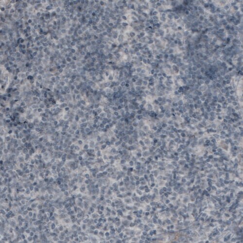 CA125/MUC16 Antibody (CL2783) - Azide and BSA Free Immunohistochemistry-Paraffin: CA125/MUC16 Antibody [NBP3-44101]