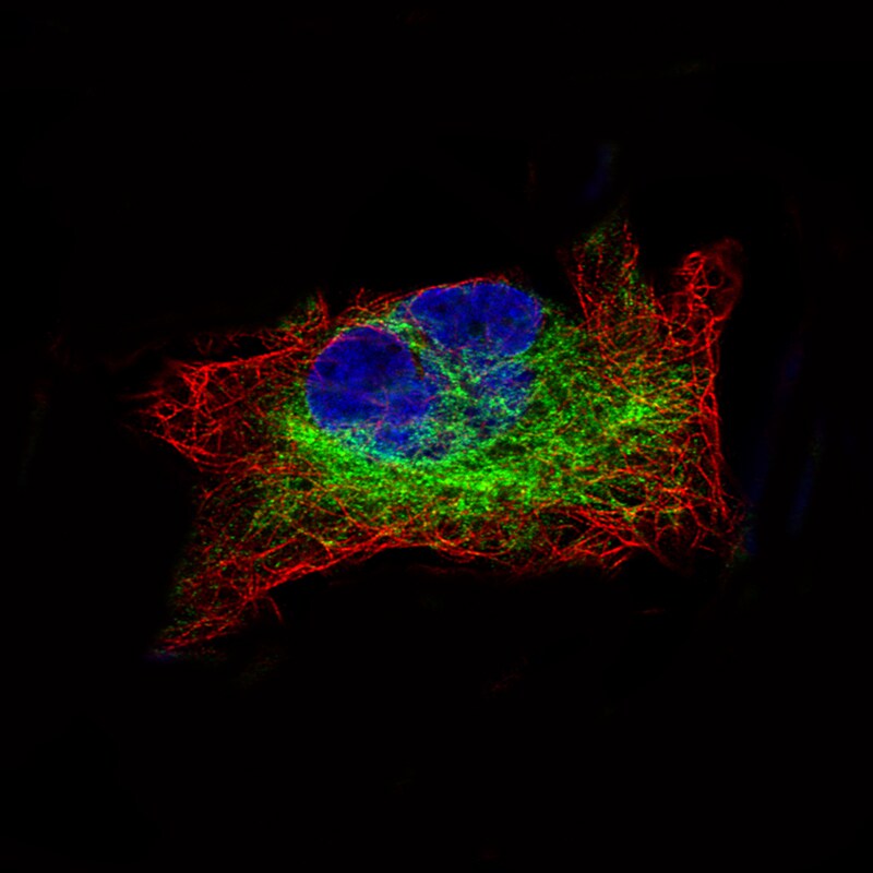 Desmin Antibody (CL4501) - Azide and BSA Free Immunocytochemistry/ Immunofluorescence: Desmin Antibody [NBP3-44102]