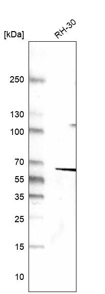 Desmin Antibody (CL4502) - Azide and BSA Free Western Blot: Desmin Antibody [NBP3-44103]