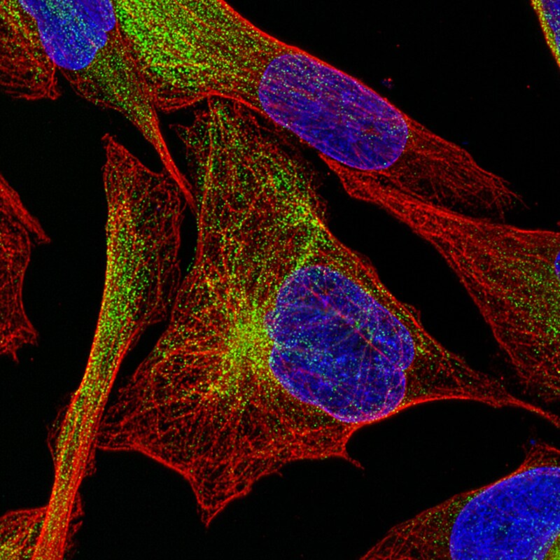 Desmin Antibody (CL4502) - Azide and BSA Free Immunocytochemistry/ Immunofluorescence: Desmin Antibody [NBP3-44103]