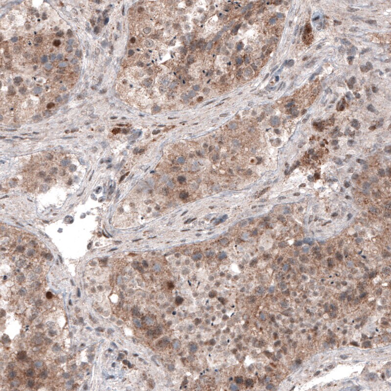 USP30 Antibody (CL4438) - Azide and BSA Free Immunohistochemistry-Paraffin: USP30 Antibody [NBP3-44104]