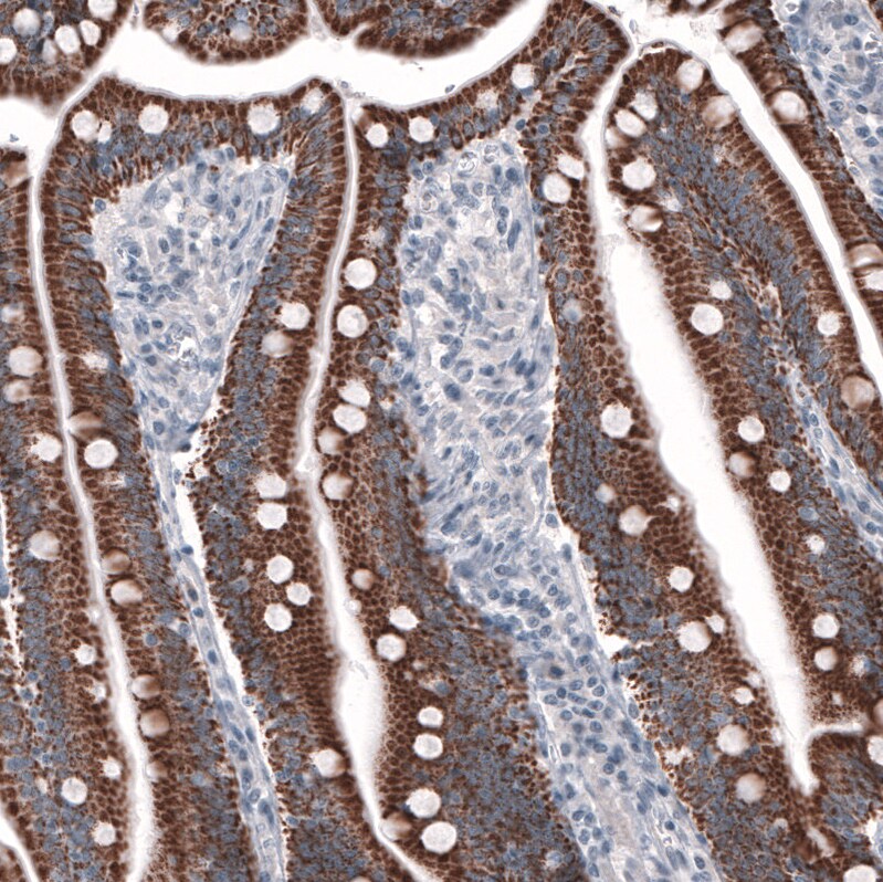 Ornithine Carbamoyltransferase Antibody (CL4046) - Azide and BSA Free Immunohistochemistry-Paraffin: Ornithine Carbamoyltransferase Antibody [NBP3-44106]