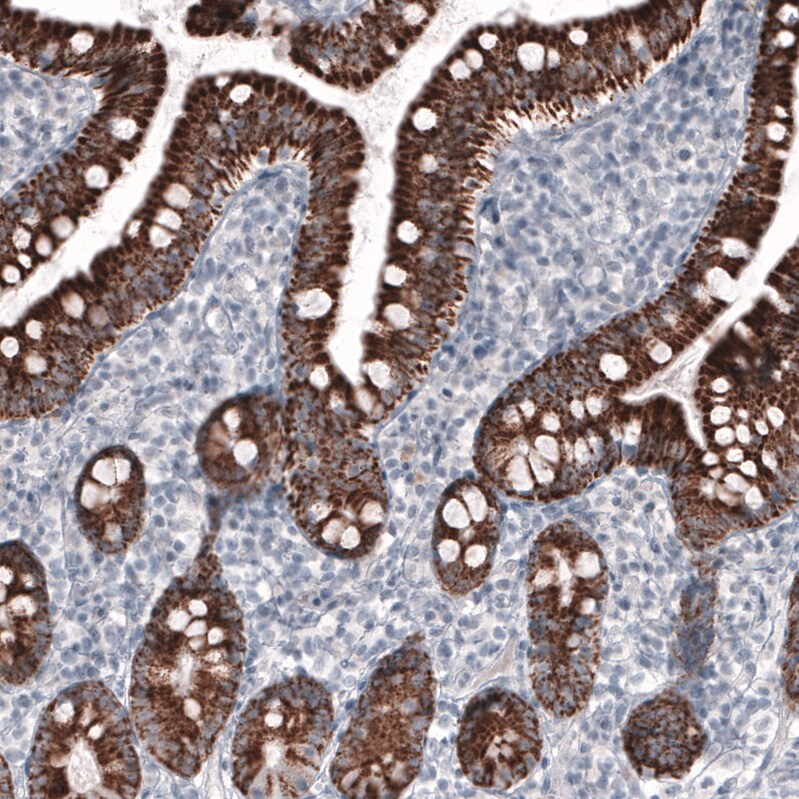Ornithine Carbamoyltransferase Antibody (CL4046) - Azide and BSA Free Immunohistochemistry-Paraffin: Ornithine Carbamoyltransferase Antibody [NBP3-44106]