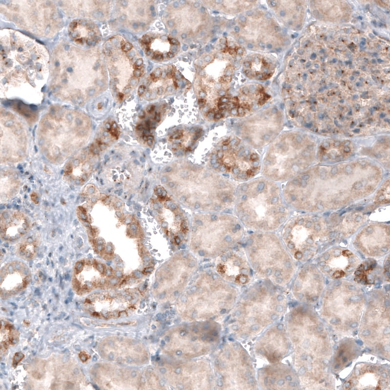 CLIP170 Antibody (CL4844) - Azide and BSA Free Immunohistochemistry-Paraffin: CLIP170 Antibody [NBP3-44108]